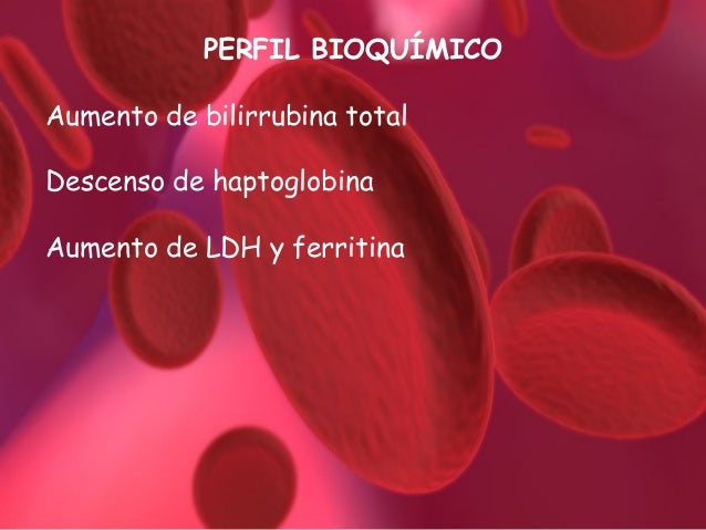 hiperesplenismo en nios